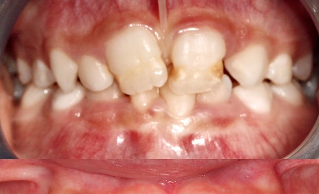 Foto de CLÍNICA DENTAL MOZAS | Ortodoncia invisible Vitoria-Gasteiz | Periodoncia | Dentista | Implantes