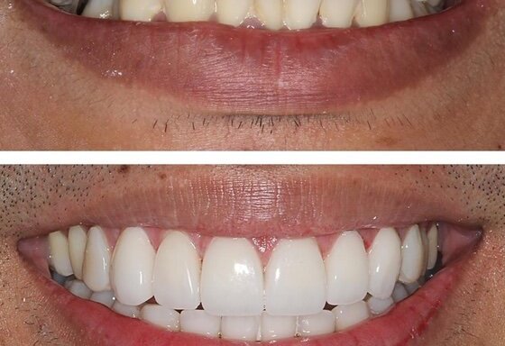 Photo of HAPI Dental