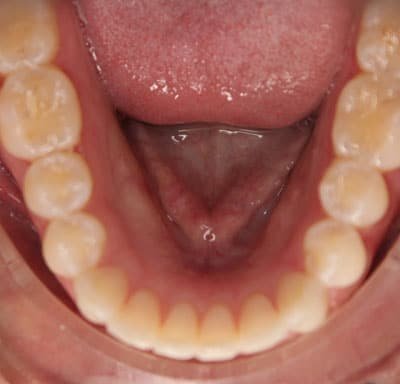 Photo of Gibbs Orthodontic Associates, P.C: Invisalign, Braces and Dentofacial Orthopedics