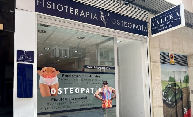 Foto de 🟢Clínica Valera | Fisioterapia y Osteopatía en Albacete