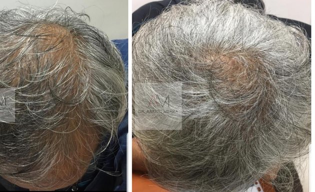 Photo of SkinGenious Colaba | HIFU treatment, Lip fillers, Hair, skin specialist clinic
