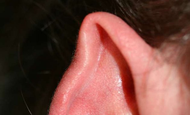Photo of ear Aesthetics and Reconstruction