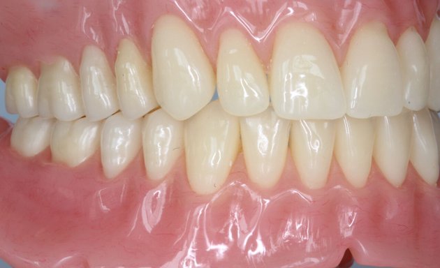 Photo of In-Home Dentures