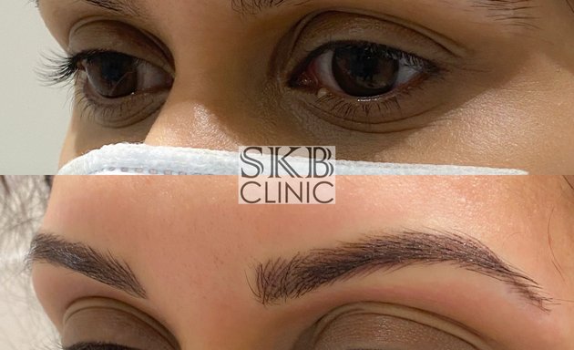 Photo of SKB Clinic Microblading & Permanent Makeup