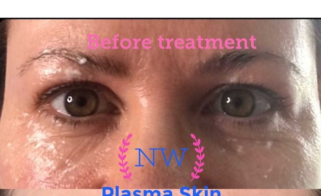 Photo of North West Plasma Skin Aesthetics