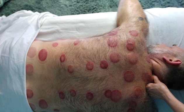 Photo of CuppingNYC