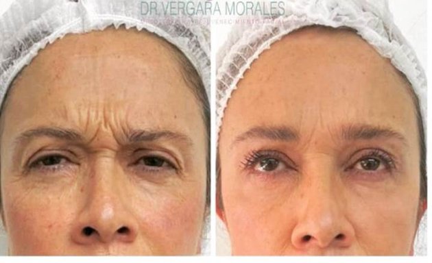 Foto de Dr. Vergara Morales, Odontología - Armonización Facial - Bichectomía - Hilos Tensores - Ácido Hialurónico - Botox