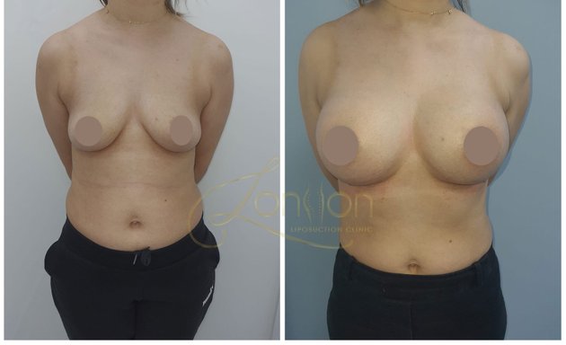 Photo of London Liposuction Clinic