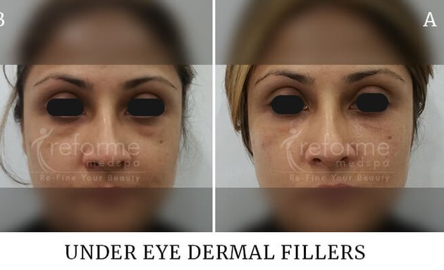 Photo of Beauty Advance skin & Laser Clinic