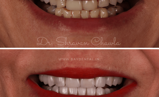 Photo of Bay Dental Associates : Teeth Whitening & Cleaning | Root Canal Treatment | Dental Clinic in Grant Road | Dentist in Grant Road | Pediatric Dentistry | Orthodontist | Dental Implants | Braces , Crown , Smile Makeover in Grant Road