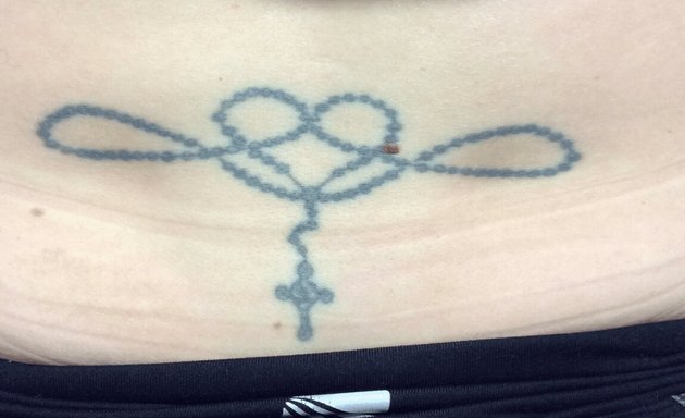 Photo of Removery Tattoo Removal & Fading