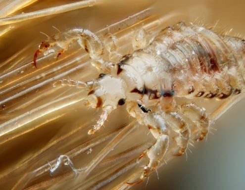 Photo of Lice Clinics of America - San Antonio West