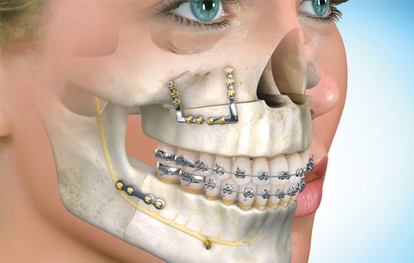 Photo of Bekish Orthodontics