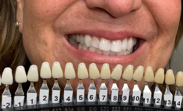 Photo of Lux Natural Teeth Whitening