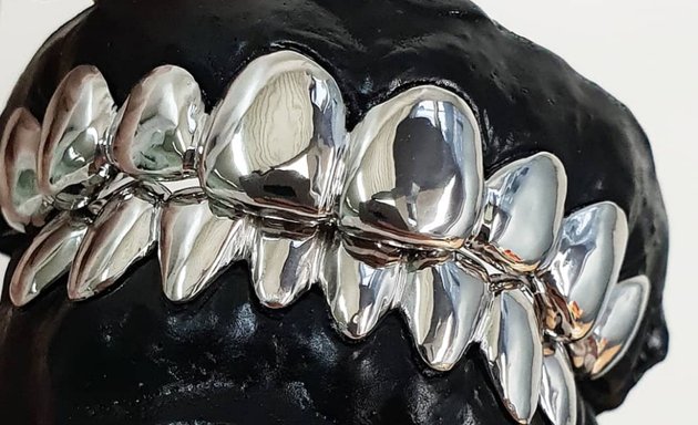 Photo de Grillz Botte Frères