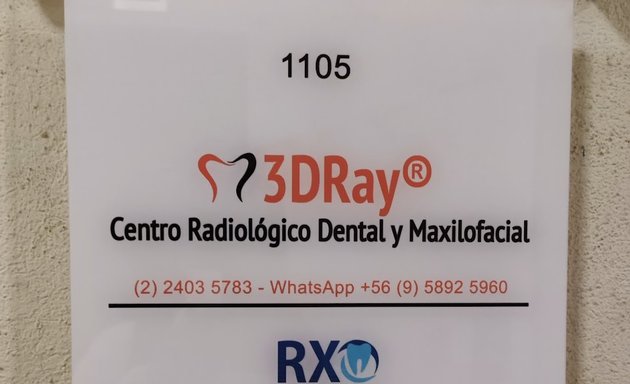 Foto de Radiografías Dentales - 3DRay El Llano