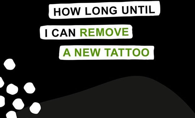 Photo of NO INK Tattoo Removal & Fading