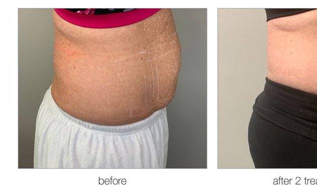 Photo of Flawless Laser & Body Sculpting