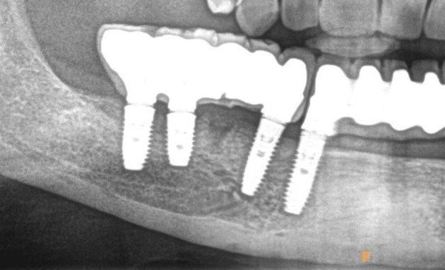 Photo of Journal of Dental Implants and Lasers