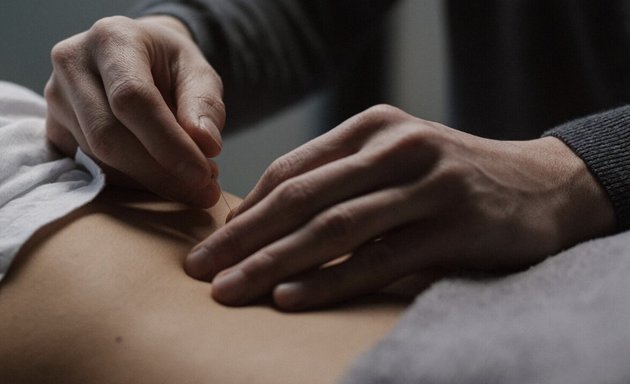 Photo of Acupuncture, Zach Olesinski R.Ac