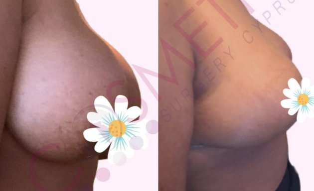 Photo of Cosmetic Surgery Cyprus