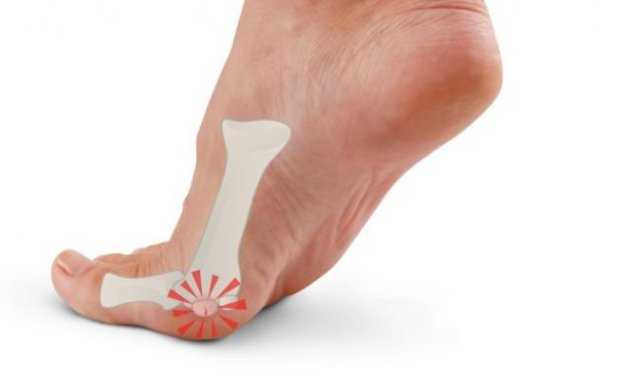 Photo of Optimum Care Foot & Ankle Clinic - Podiatrist Richmond