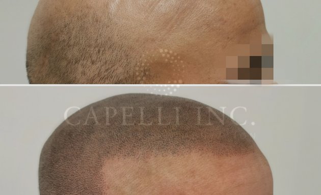 Photo of Capelli Inc Scalp Micropigmentation Liverpool