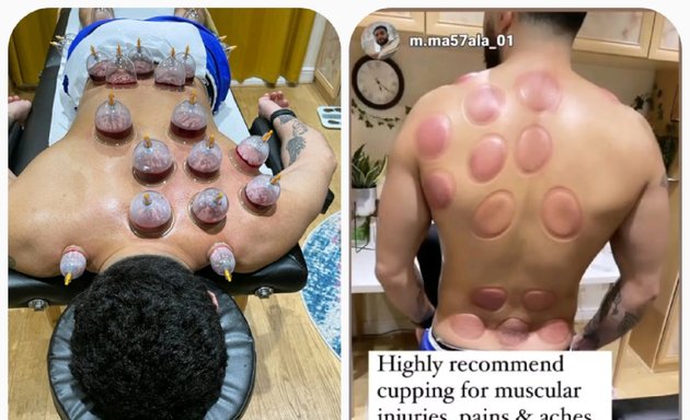 Photo of Ealing Cupping & Healing Clinic