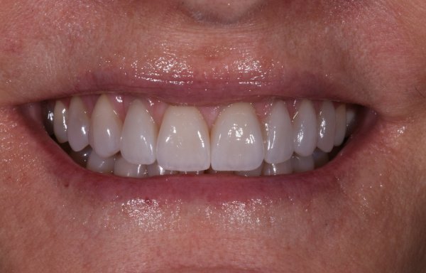 Photo of Weston Spencer DDS, Cosmetic Comprehensive Dentistry