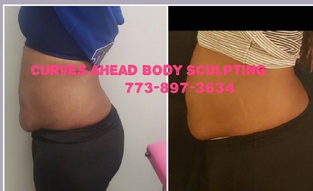 Photo of Curves Ahead Body Sculpting