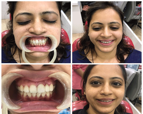 Photo of Dental Perfection : Dental Implants | Smile Design | Crown | Bridges | Denture | Teeth Whitening | Oral surgeon | Root Canal Treatment | Home Visit | Cosmetic & Cheap & Kids Dentist | Best Dental Clinic | Best Dentist in Goregaon