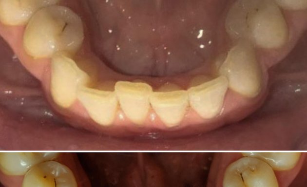 Photo of Teeth Straightening Swindon
