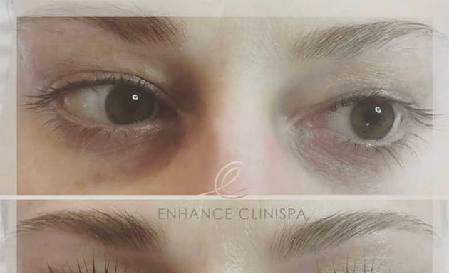 Photo of Enhance Clinispa Skin Clinic