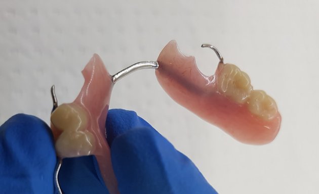 Photo of Denture Repairs