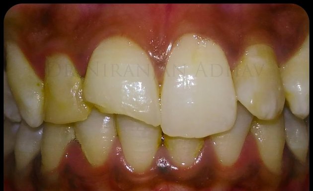 Photo of EVERYOUTH DENTAL | Dr. Niranjan Adhav | Dentist | Prosthodontist | Implantologist | Dental Clinic at Ghatkopar | Dental Implants | Dentures | Crowns and Bridges | Root Canal Treatment | Cosmetic Dentistry | Teeth Cleaning | Veneers | Fillings