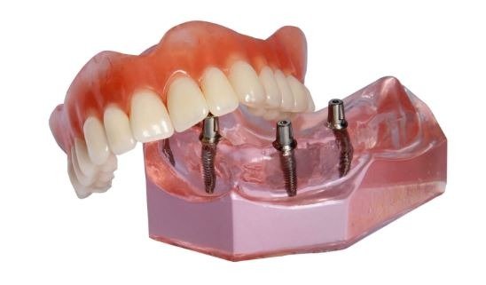 Photo of Gustavo Denture & Implant Centre