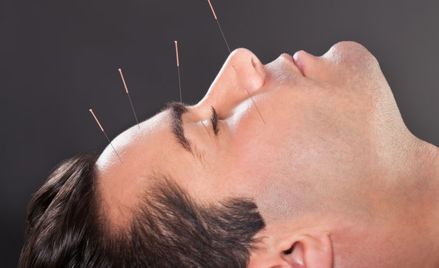 Photo of Dan's Acupuncture