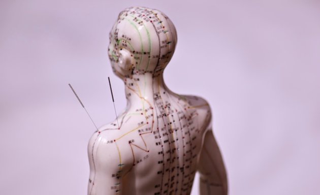 Photo of Acupuncture Plus