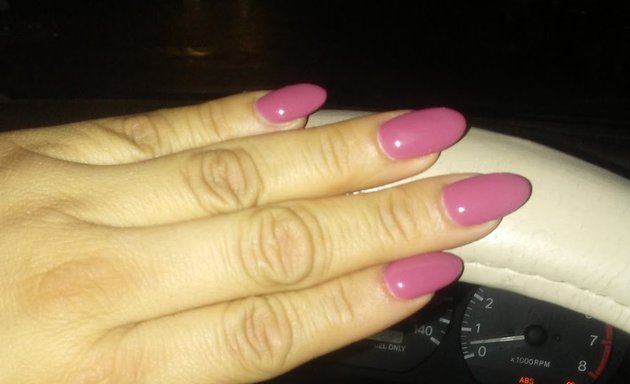 Photo of Miracle Nails