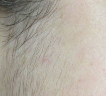 Photo of Bare Body Laser & Skin Clinic