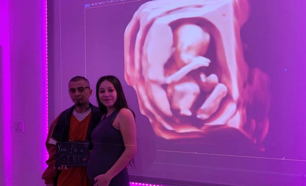 Photo of My Baby Debut 3D 4D HD Ultrasound