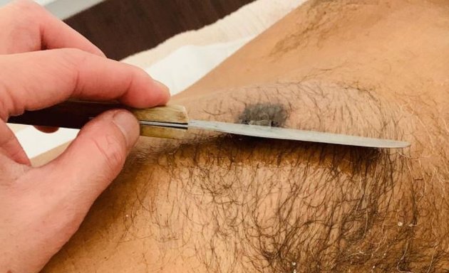 Photo of Aedie Sugaring Body Hair Removal
