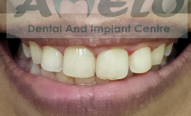 Photo of AMELO-Dental and Implant Centre