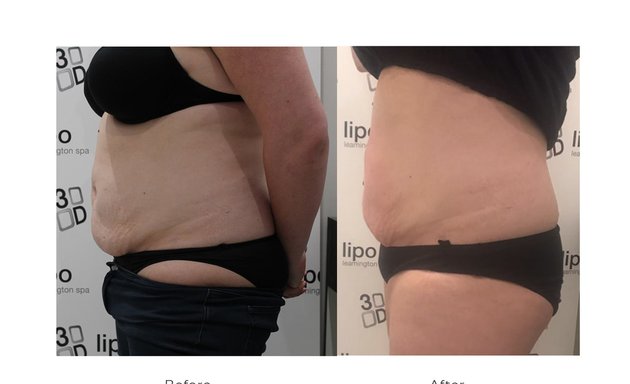 Photo of The Beauty Clinic 3D Lipo and Aesthetics