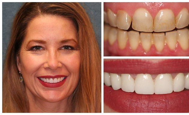 Photo of Charles Martin DDS South Tampa