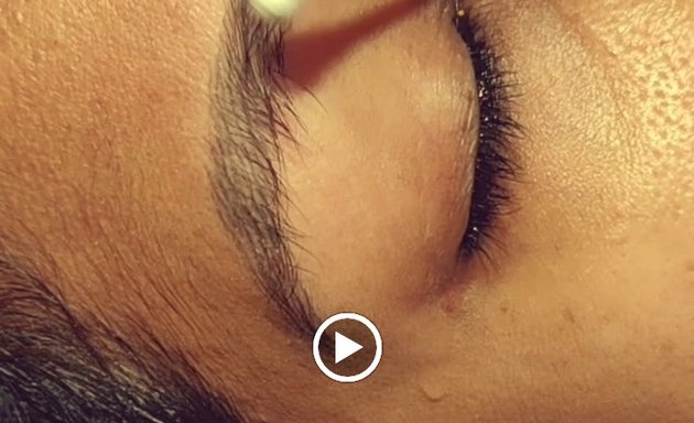 Photo of EAA BROWS by Dr.Sajesh