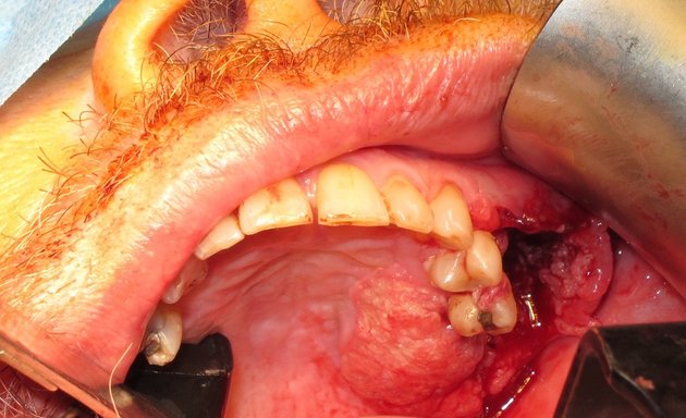 Photo of Maxillofacial Prosthodontics UK