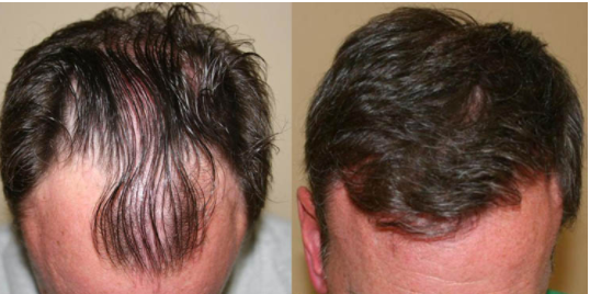 Photo of San Diego Hair Restoration - DeYarman Medical