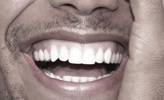 Photo of Sirois Denturologistes | Prothèses dentaires