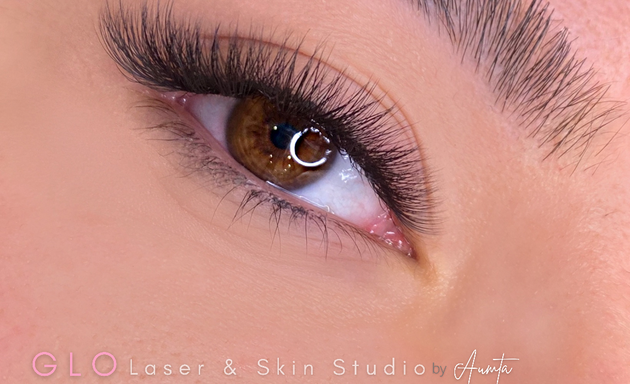 Photo of GLO Laser & Skin Studio